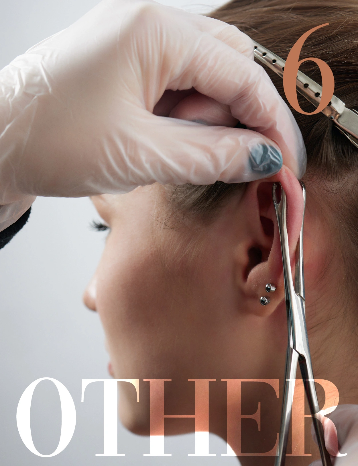 Other treatments